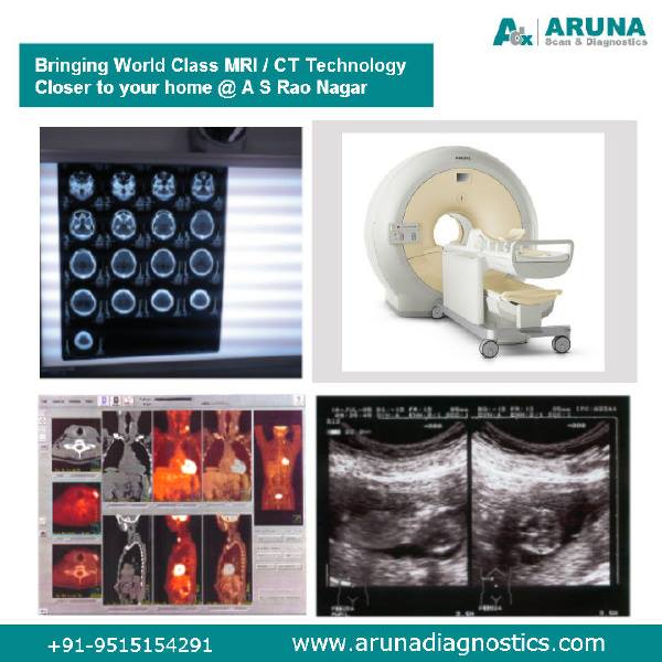 Aruna Scan and Diagnostics Center | MRI Scanning | CT Scanning